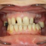 smile gallery before photo